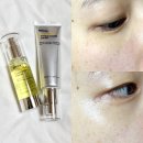 ㈜파이헬스케어 | 올리브영 잡티케어 추천템, 로벡틴 비타세럼&amp;비타토닝크림 효과본 후기