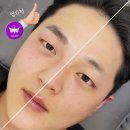 리안메디센터 | 전포동눈썹문신 남자도 만족하는 이유