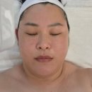 오유에스테틱 - 강서구 | 대구 중구 피부관리 제이스오유에스테틱 엑소좀 줄기세포 스킨부스터 후기
