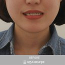 아인스덴탈 네이버블로그