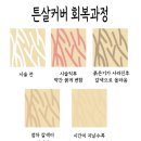 수인스킨케어 | 분당 '주블링&amp;스킨52' 에서 받은 허벅지 튼살커버 1회차 후기