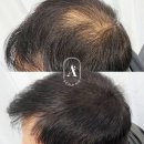 일산두피&눈썹단미토탈뷰티