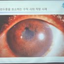 새로안안경부평센터