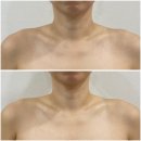 세종웨딩관리, 세종피부샵, 가온뷰티 왁싱앤스킨, vvip웨딩관리 후기