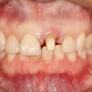 편한치과기공소 이미지