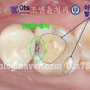 윤치과기공소 이미지
