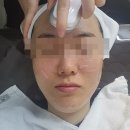 메디스킨 | 동성로피부관리샵 데자뷰메디스킨 후기