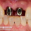 바른이치과기공소 이미지