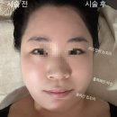 리베라뷰티샵 | 창원 스페이스뷰티, 두피케어와 리프팅관리 끝판왕! 두피부터 끌어올리는 리프팅, 두피케어 찐후기