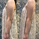 메디365 | [광주 웨딩관리] 결혼 앞두고 팔뚝살 안 빠져서 고민이라면? 365메디스킨 광주본점 극초단파 리얼 후기!