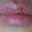 청년약국 이미지