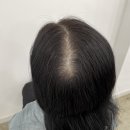 림스칼프 이미지