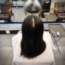 뒤통수 | 모류교정 링거펌으로 해결한 성남 긴머리 가르마 갈라짐 후기｜뒤통수까지 쩍 갈라지는 모발 교정