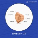 성모보청기 이미지