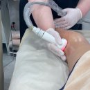 탑메디칼 | 낙성대 리프팅 종아리관리로 고주파와 에어샷, 샤인탑 스킨앤왁싱