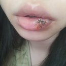 탑스치과의원 | 천안입술봉합수술,탑스마일의원,순천향대응급실