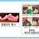 이플란치과의원 이미지