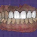 탑치과기공소 이미지