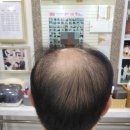셀모가발 이미지