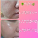 라온&#39;S 뷰티와 함께하는 인셀덤 무료체험