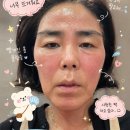 인셀덤뷰티샤워 | 리만 ICD 인셀덤 바르고 피부가 건조하고 당긴 이유, 저도 처음엔 몰랐습니다