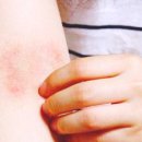 눈꽃피부과의원 이미지