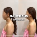 (A+)바른케어 | 청라 바른에스테틱 윤곽집중관리 속근육부터 부드럽게 풀어주는 마사지 후기