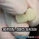 캘리포니아치과기공소 이미지