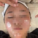 노원어린이집 | [리뷰] 노원에스테틱 르모어스킨 노원스킨플래닝 후기