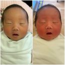 도담순천동물약국 | 순천현대여성 쌍둥이 제왕절개 후기 페인버스터+무통+진통제