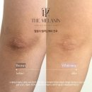 후스킨케어 이미지