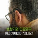 와우보청기 이미지