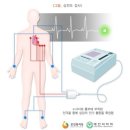 경피적 관상동맥 중재술 (PCI: Percutaneous Coronary Intervention) 이미지