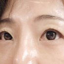 천리안안경.위드렌즈증평점 이미지