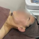 계미정치킨 | 이천 에스테틱 관리 잘하는 곳 [리타임뷰티] 윤곽관리 받은 후기