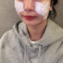 댕겨오겠습니다 | 땅콩형 얼굴 볼패임 스컬트라 내돈내산 솔직 후기