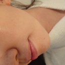 필 | 간석동 에스테틱 엘레나이젠 부스터필 후기 피부컨디션 효과