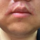 현명기피부과의원 이미지