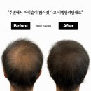 블랙인스칼프 이미지