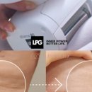 엘피메디칼 이미지