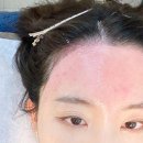 씨유천안두정대우2차점 | 천안 두정동왁싱 비엘뷰티 헤어라인 이마 왁싱 후기