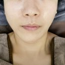 비비안나 | [강서피부관리] 메이크업비비안나 저온 플라즈마후기