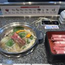 강남 아이리움안과 스마일프로 당일수술 한달 후기 + 가격 공유
