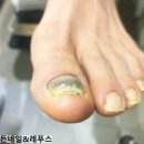 골든네일&레푸스 이미지