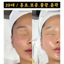 니즈웰약국 | 송우리 홍조관리 물광피부관리 /포천 피부샵