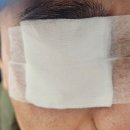 새중앙의원 | 신검단중앙역 마이눈안과 진료 후기