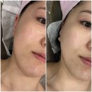 동명대학교 일반대학원 | 서면피부관리 전문점 아렌스킨 탱탱동안업리프팅 관리 후기