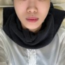 (내돈내산) 대구 동성로 올타이트 400샷 받고 하프해진 얼굴형 이중턱 투턱 리프팅받고온 후기