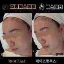 쥬니 | 부천 피부관리 “쥬니에스테틱”에서 에스테인 광채모공물광필 / 페이스핏톡스 관리받은 후기!