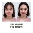 구미 피부관리 결이고은 에스테틱 재방문 얼굴축소 효과 짱